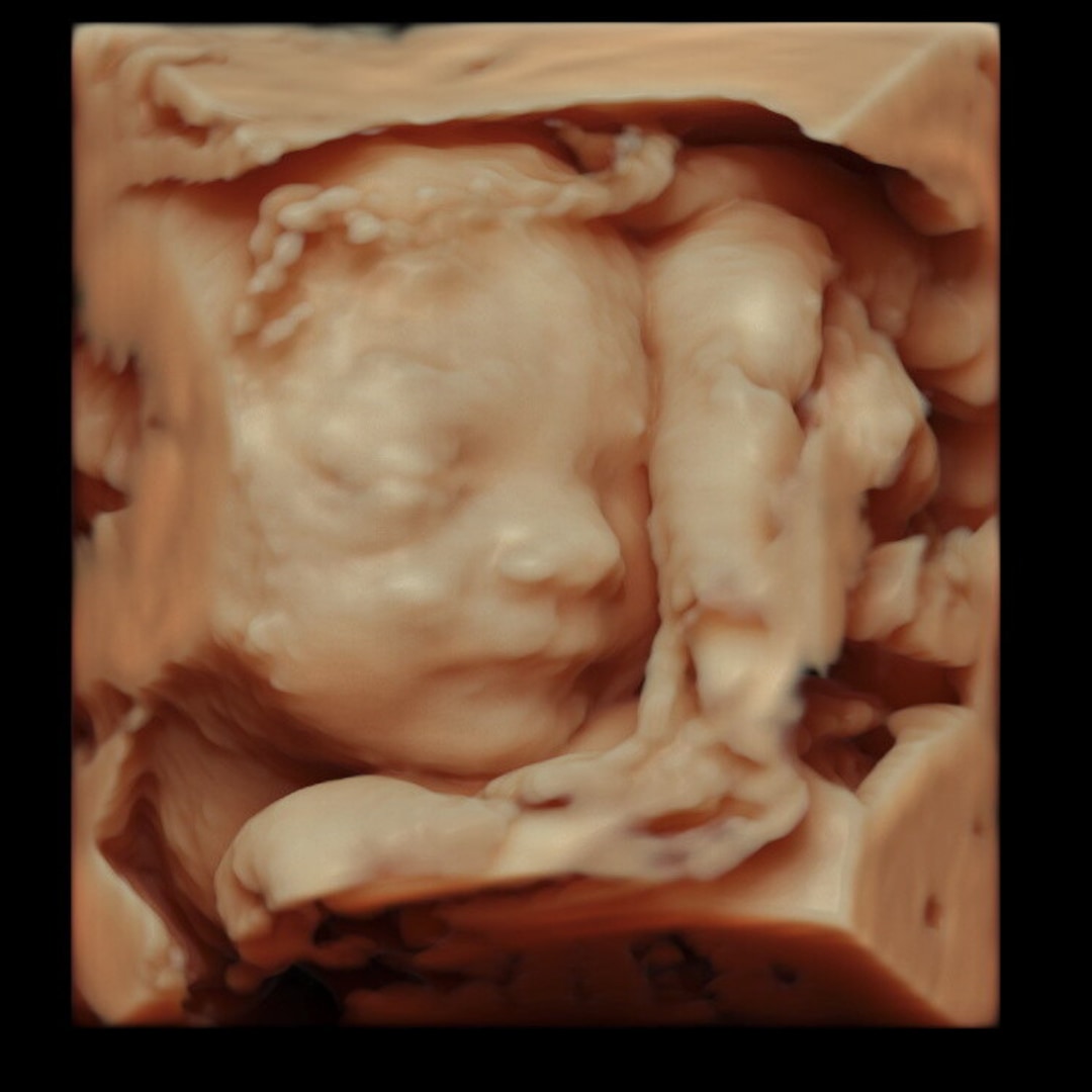 Photo shared by Araya for their Babylist baby registry.