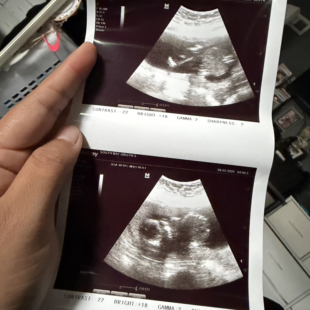 Photo shared by Danna for their Babylist baby registry.