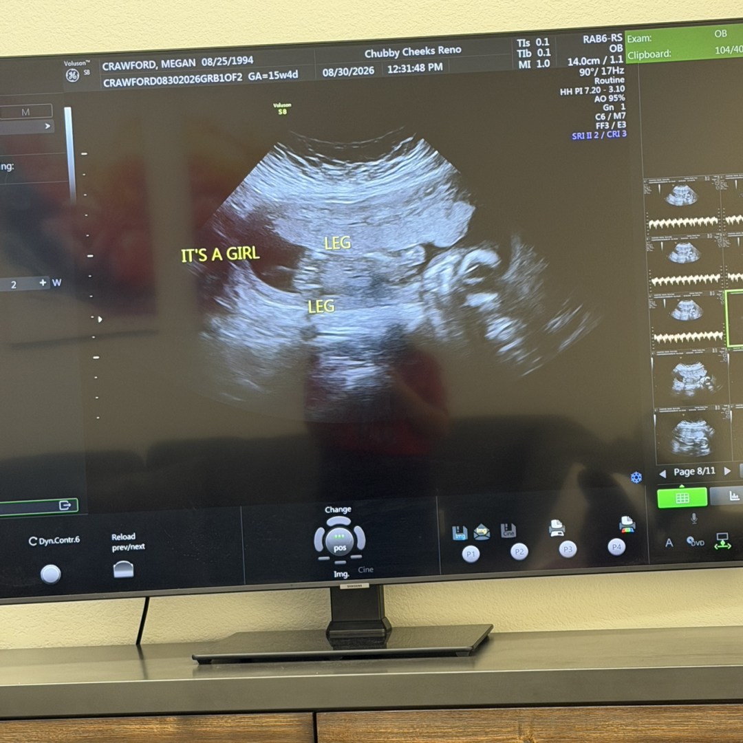 Photo shared by Megan for their Babylist baby registry.