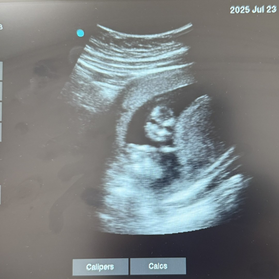 Photo shared by Krysta for their Babylist baby registry.