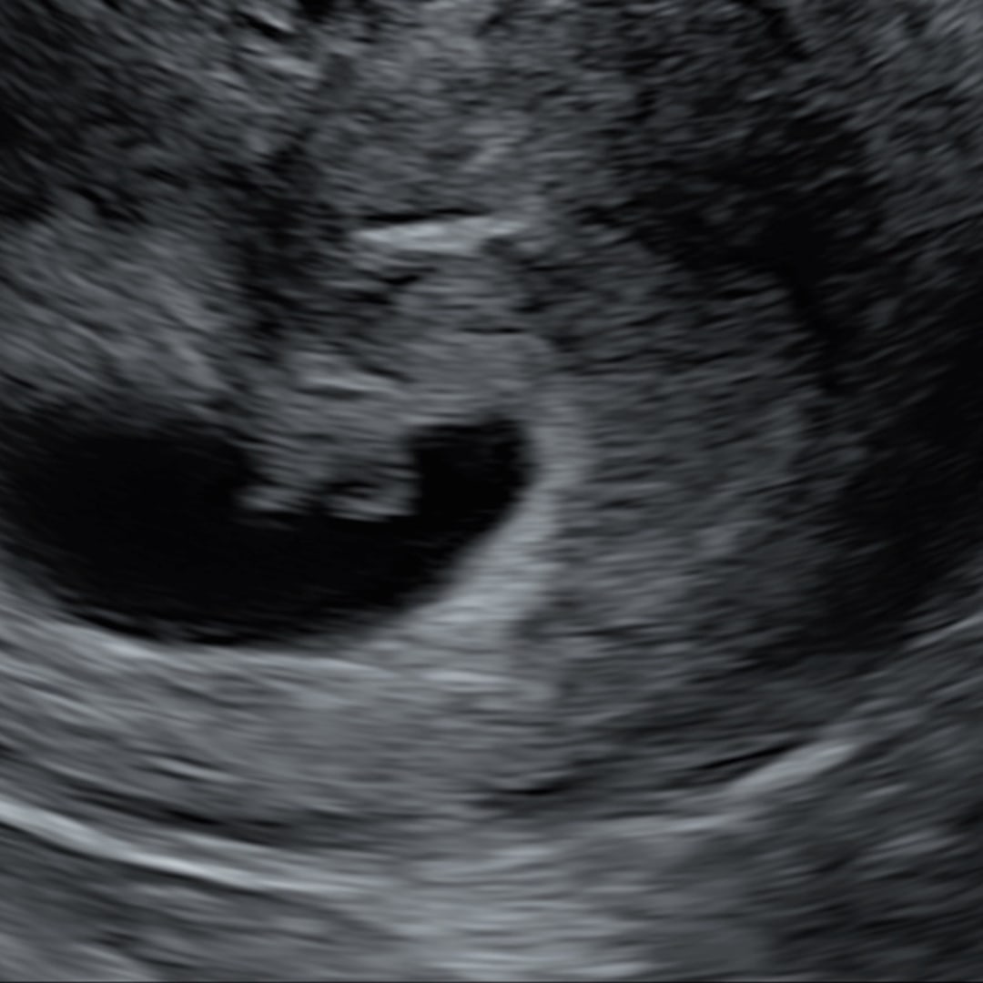 Photo shared by Nicole for their Babylist baby registry.