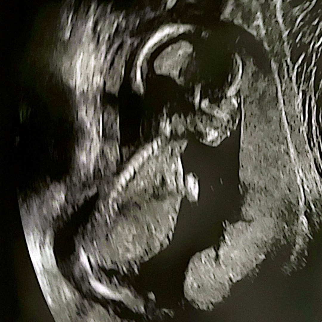 Photo shared by Alex for their Babylist baby registry.