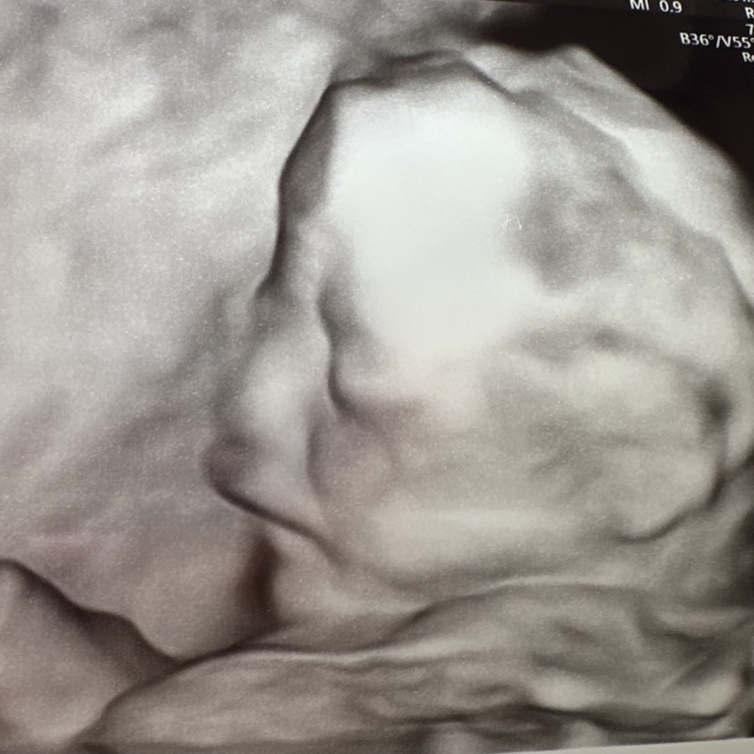 Photo shared by Annah for their Babylist baby registry.