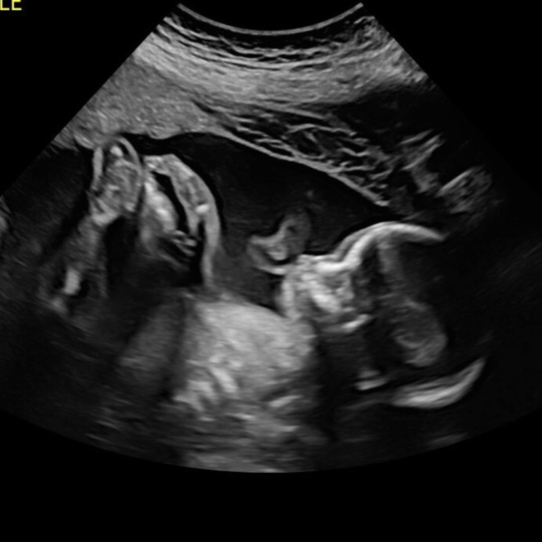 Photo shared by Emily for their Babylist baby registry.