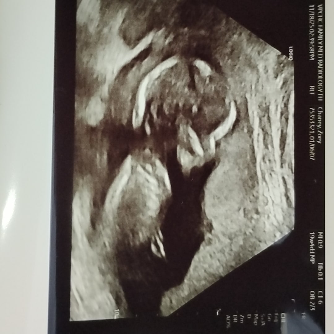 Photo shared by Zoey for their Babylist baby registry.