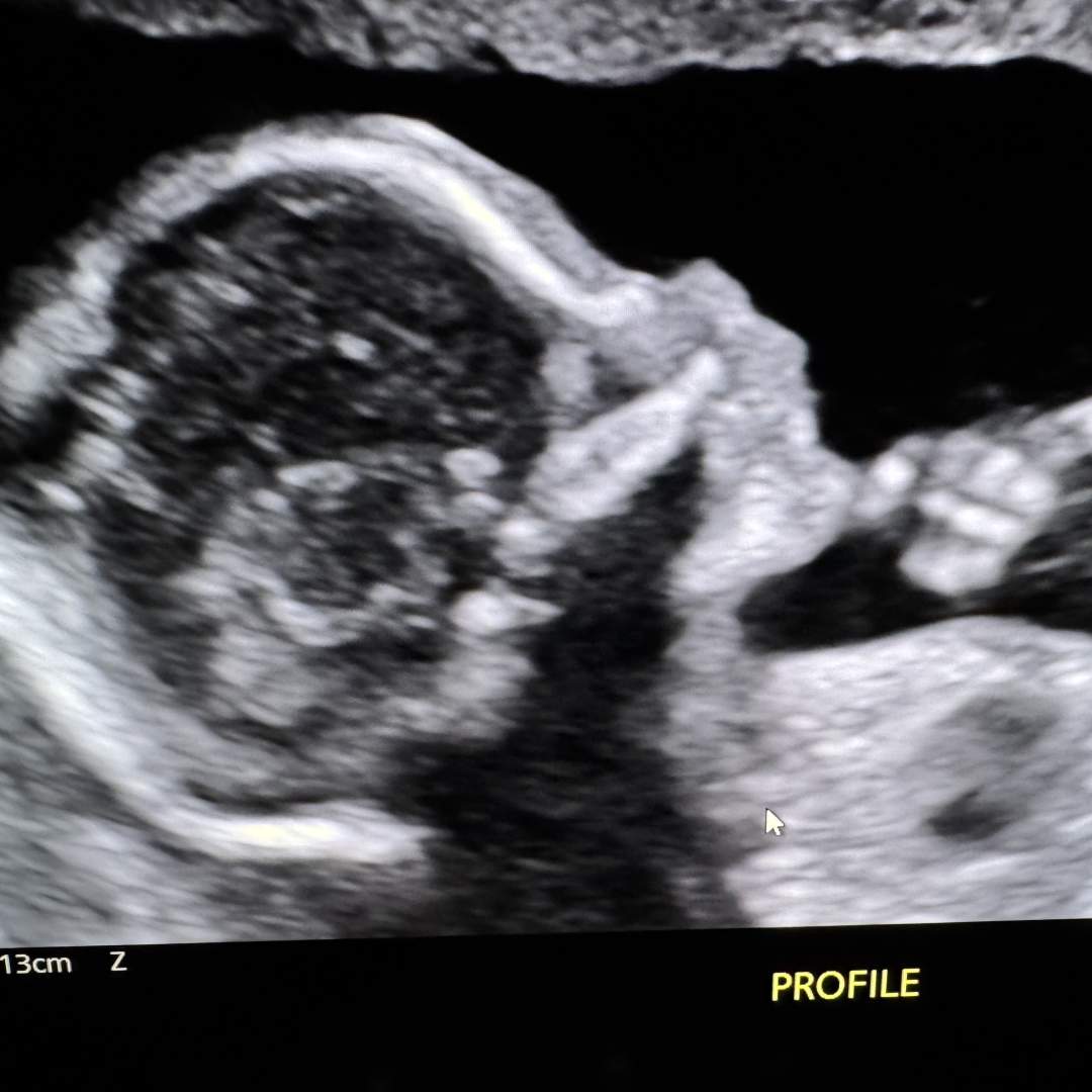 Photo shared by Jessica for their Babylist baby registry.