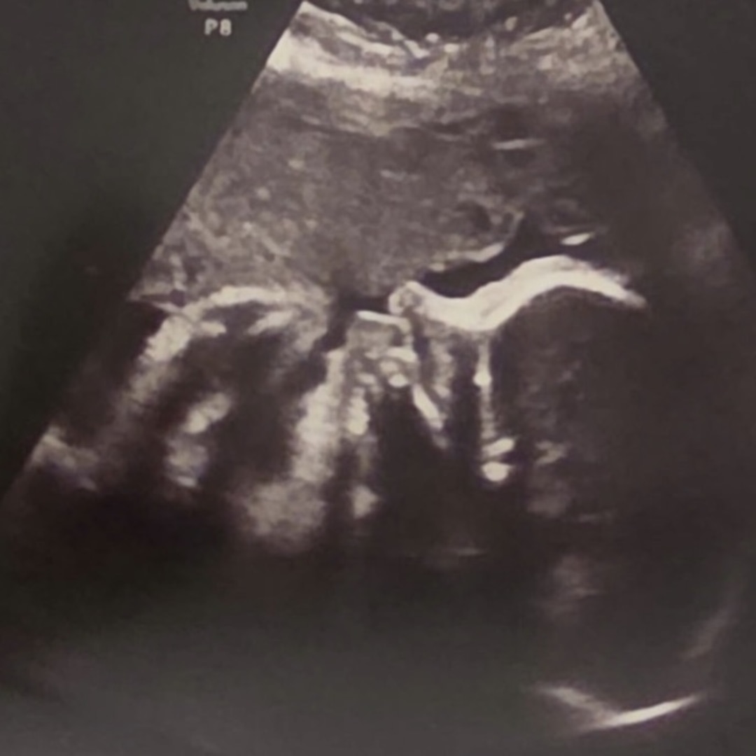Photo shared by Andrea for their Babylist baby registry.