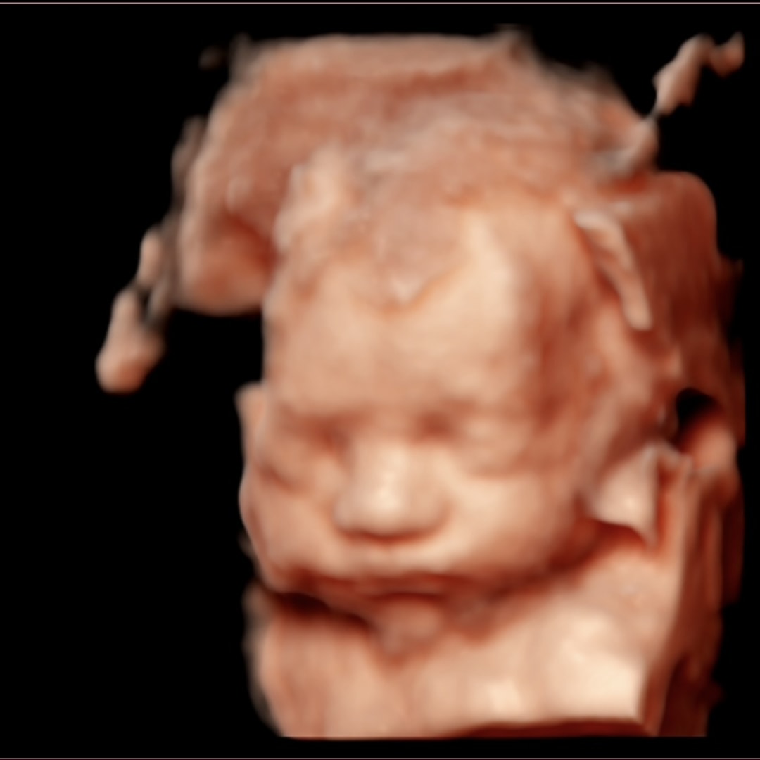 Photo shared by Marie for their Babylist baby registry.