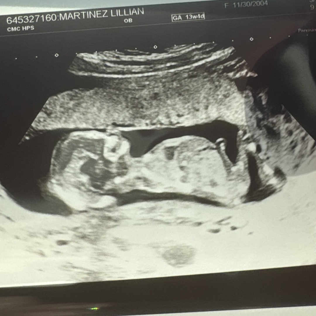 Photo shared by Lilli for their Babylist baby registry.