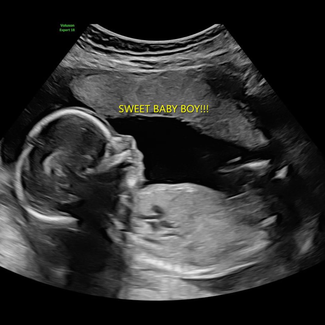 Photo shared by Beth for their Babylist baby registry.