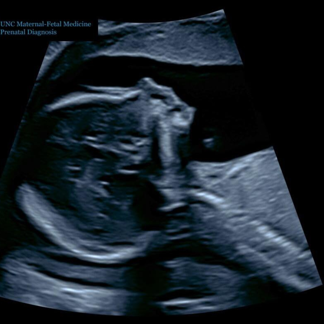 Photo shared by Cheyenne for their Babylist baby registry.