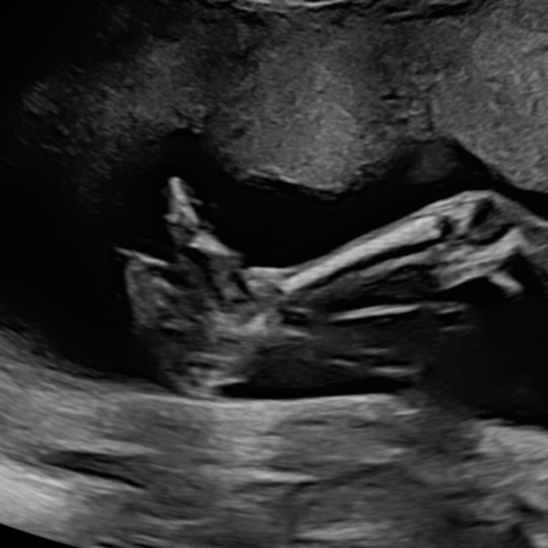 Photo shared by Madeline for their Babylist baby registry.