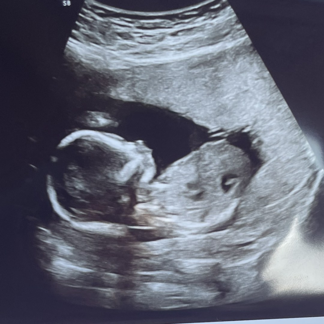 Photo shared by Joylin for their Babylist baby registry.