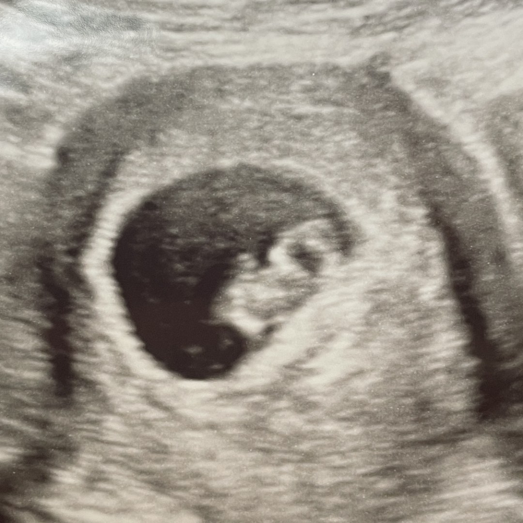 Photo shared by Emily for their Babylist baby registry.