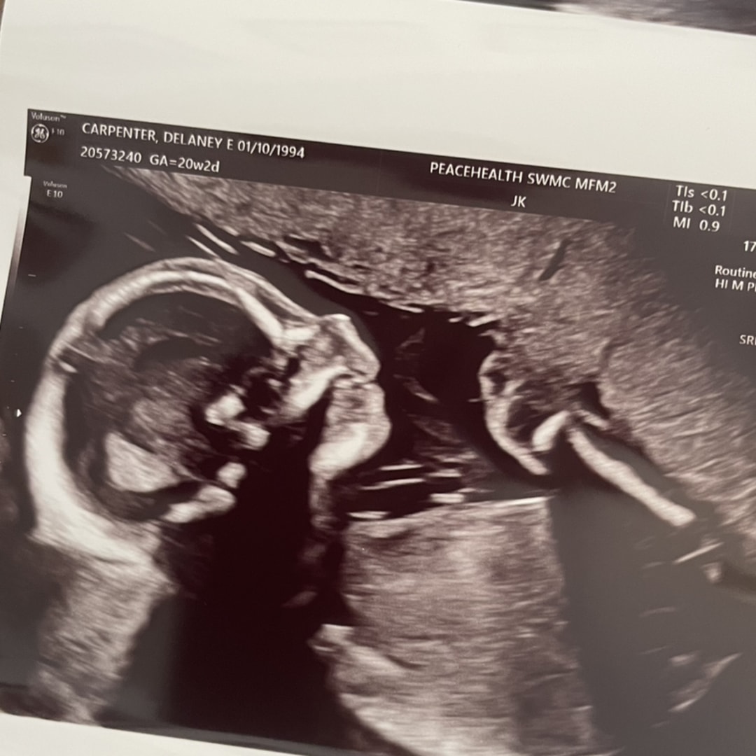 Photo shared by Delaney for their Babylist baby registry.