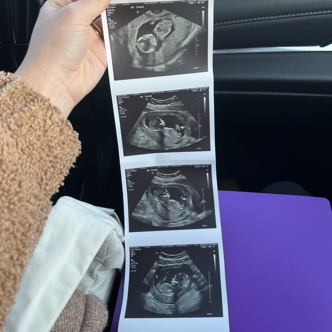 Photo shared by Mary for their Babylist baby registry.