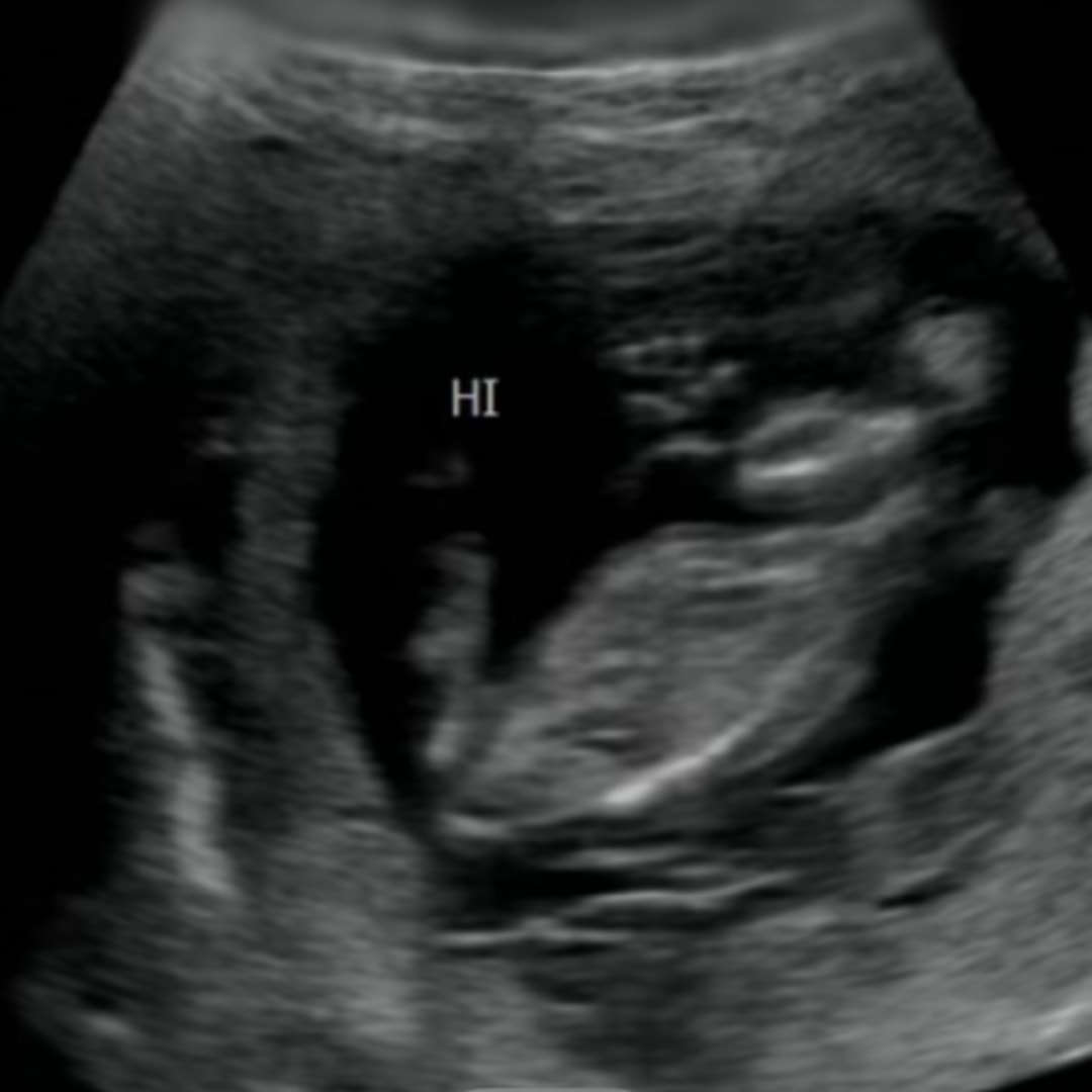 Photo shared by Addie for their Babylist baby registry.