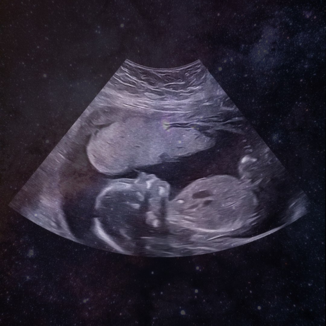 Photo shared by Emily for their Babylist baby registry.