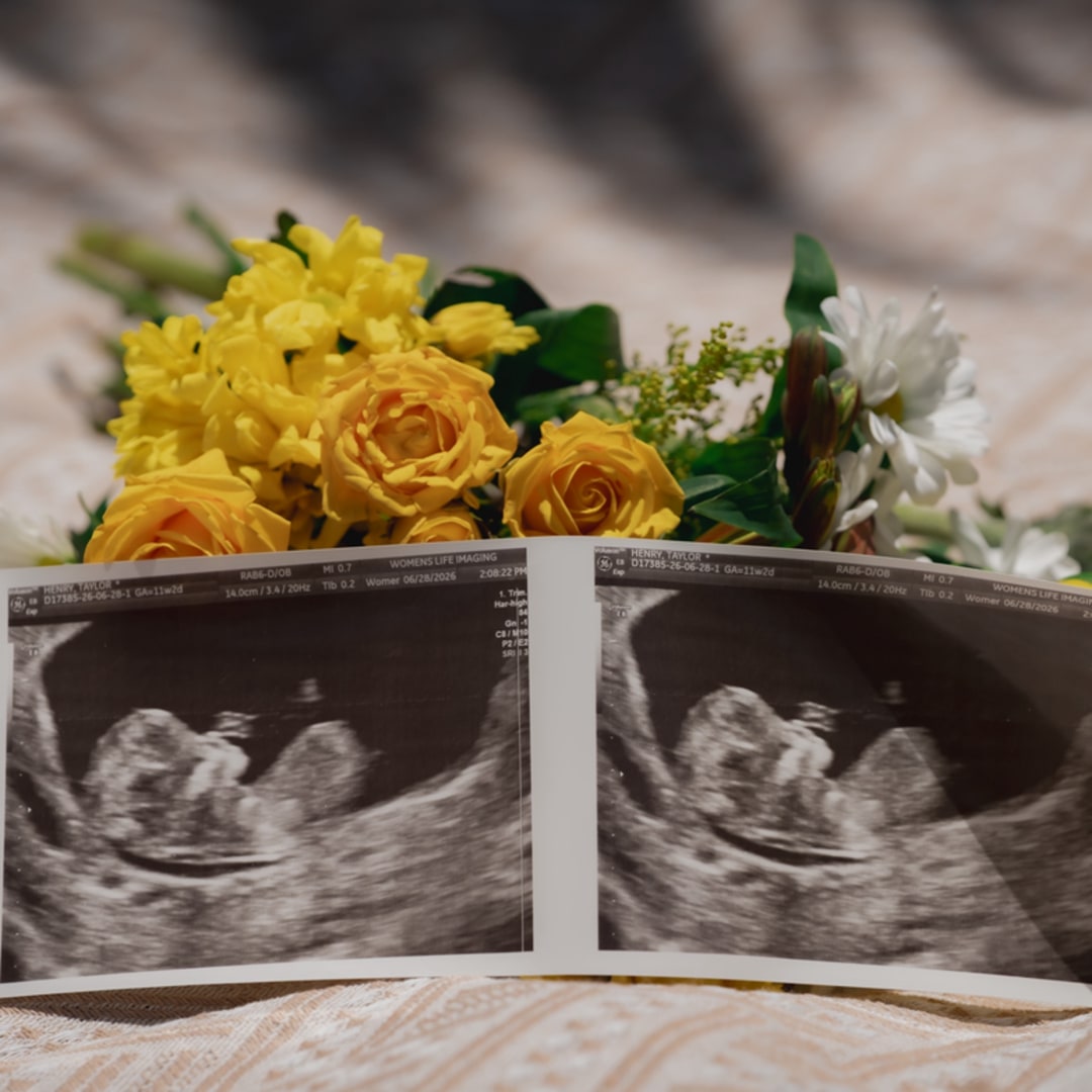 Photo shared by Taylor for their Babylist baby registry.
