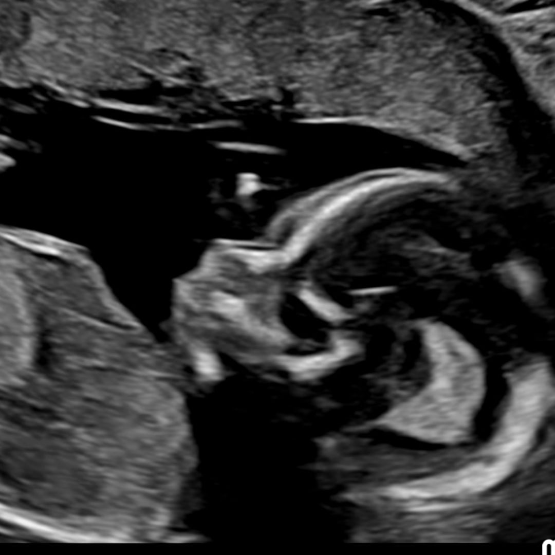 Photo shared by Dakota for their Babylist baby registry.