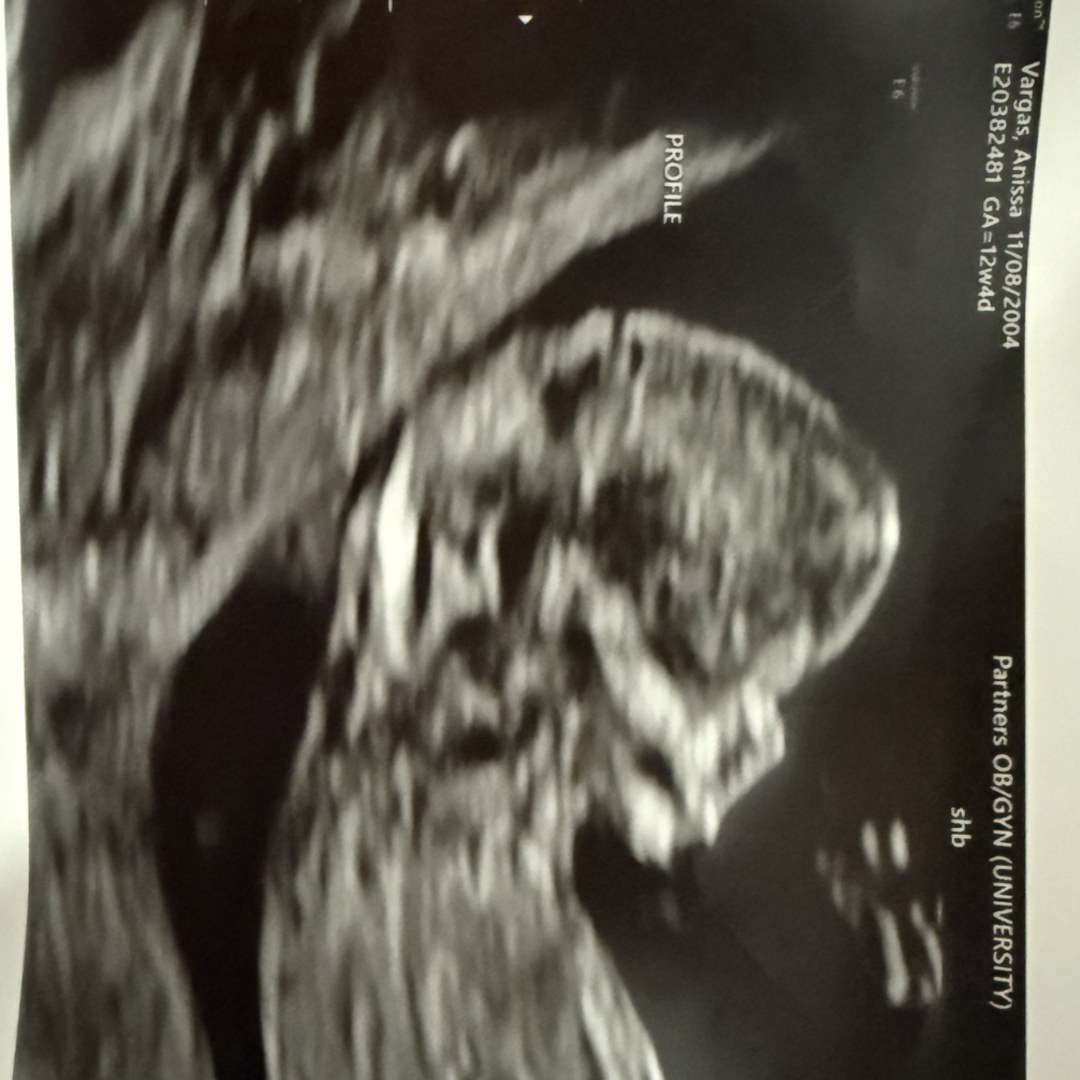 Photo shared by Anissa for their Babylist baby registry.