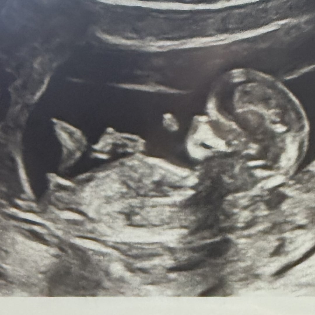 Photo shared by Kennedy for their Babylist baby registry.