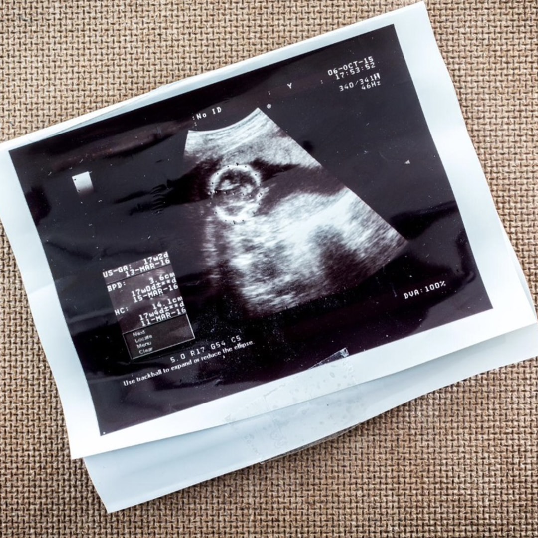 Photo shared by Elvismar for their Babylist baby registry.