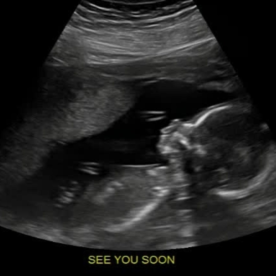 Photo shared by Anthony for their Babylist baby registry.