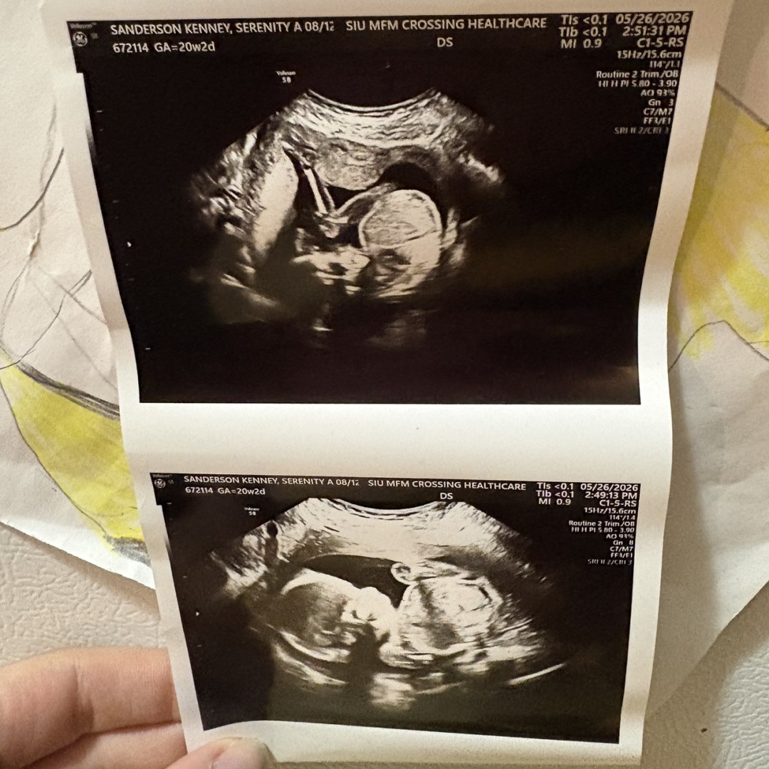 Photo shared by Serenity for their Babylist baby registry.
