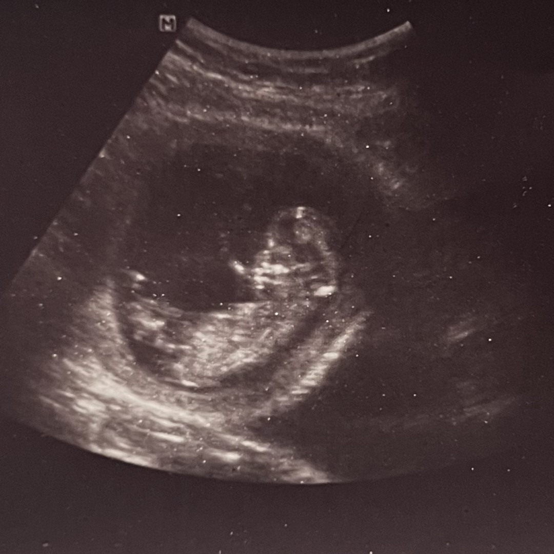 Photo shared by Mariah for their Babylist baby registry.