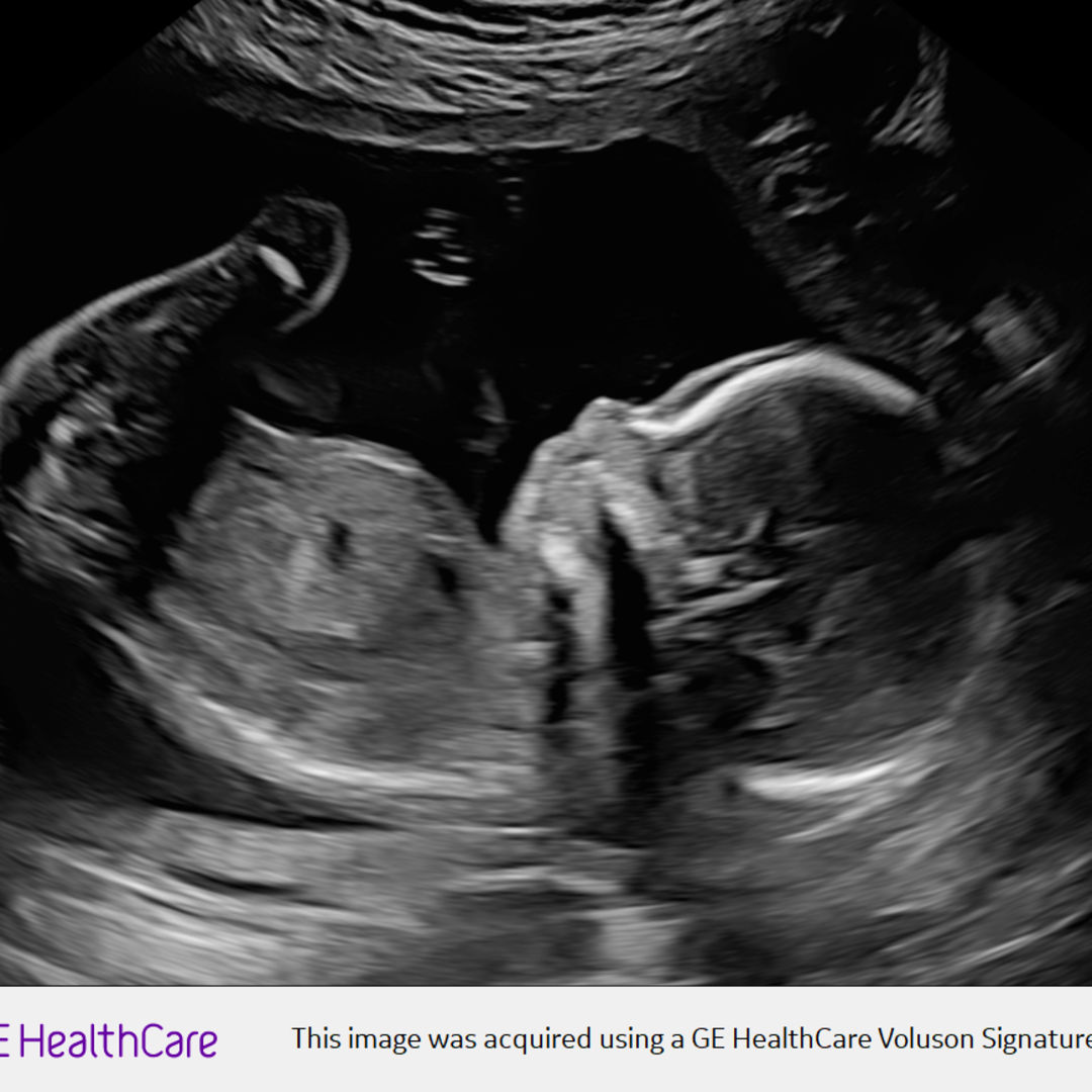 Photo shared by Elizabeth for their Babylist baby registry.