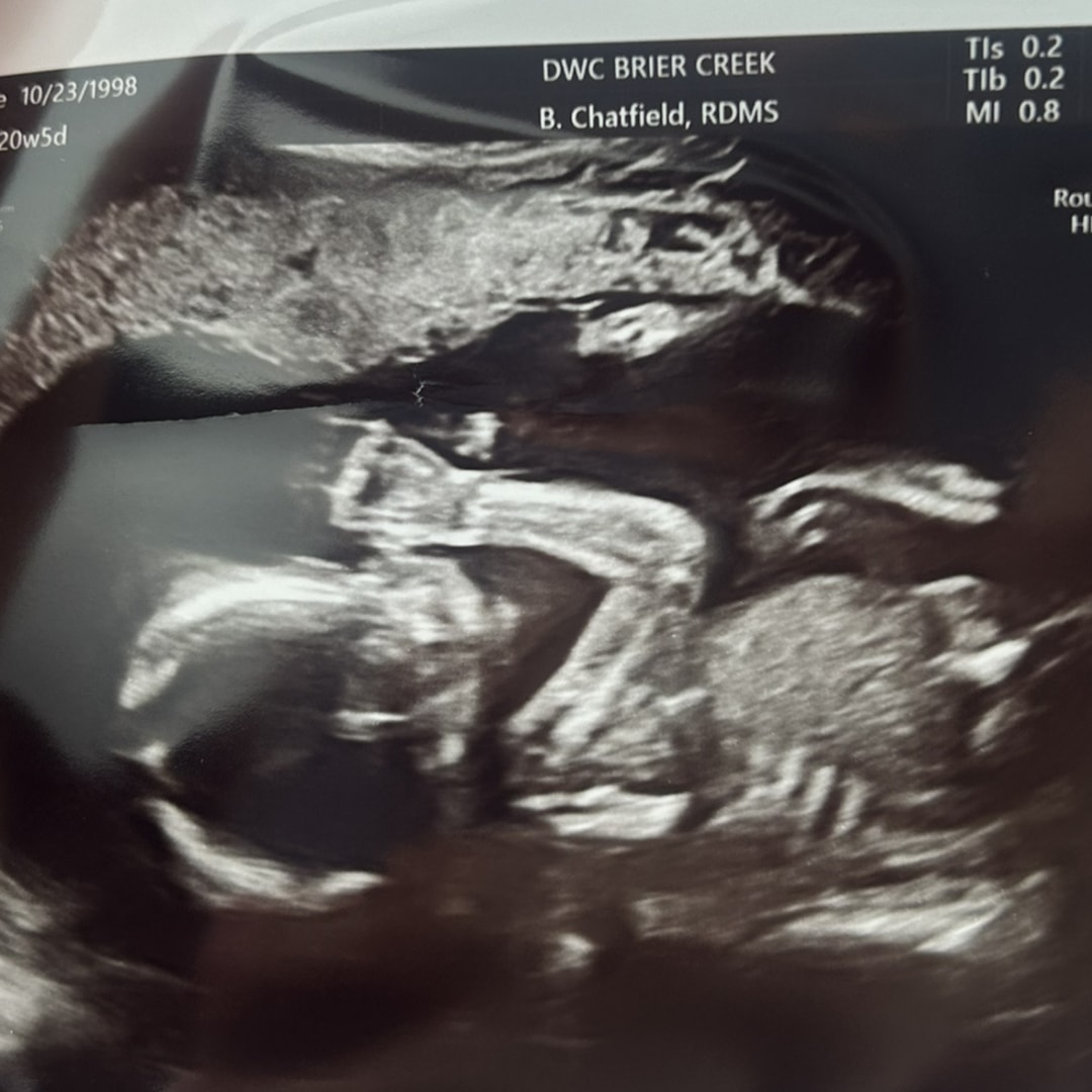 Photo shared by Caroline for their Babylist baby registry.