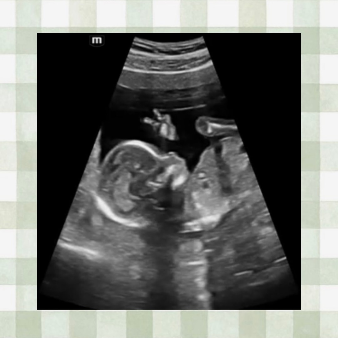 Photo shared by Colleena for their Babylist baby registry.