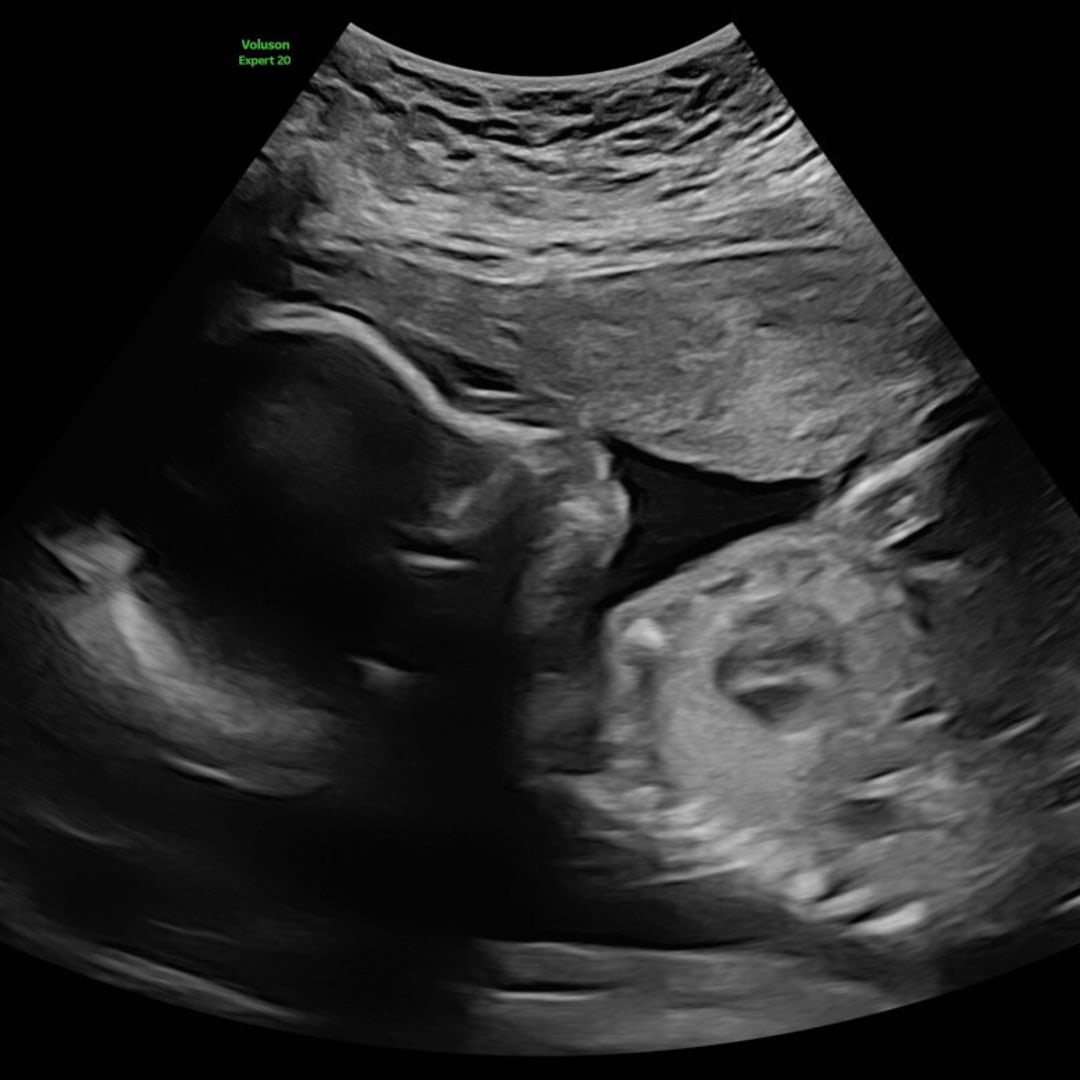 Photo shared by Whitney for their Babylist baby registry.
