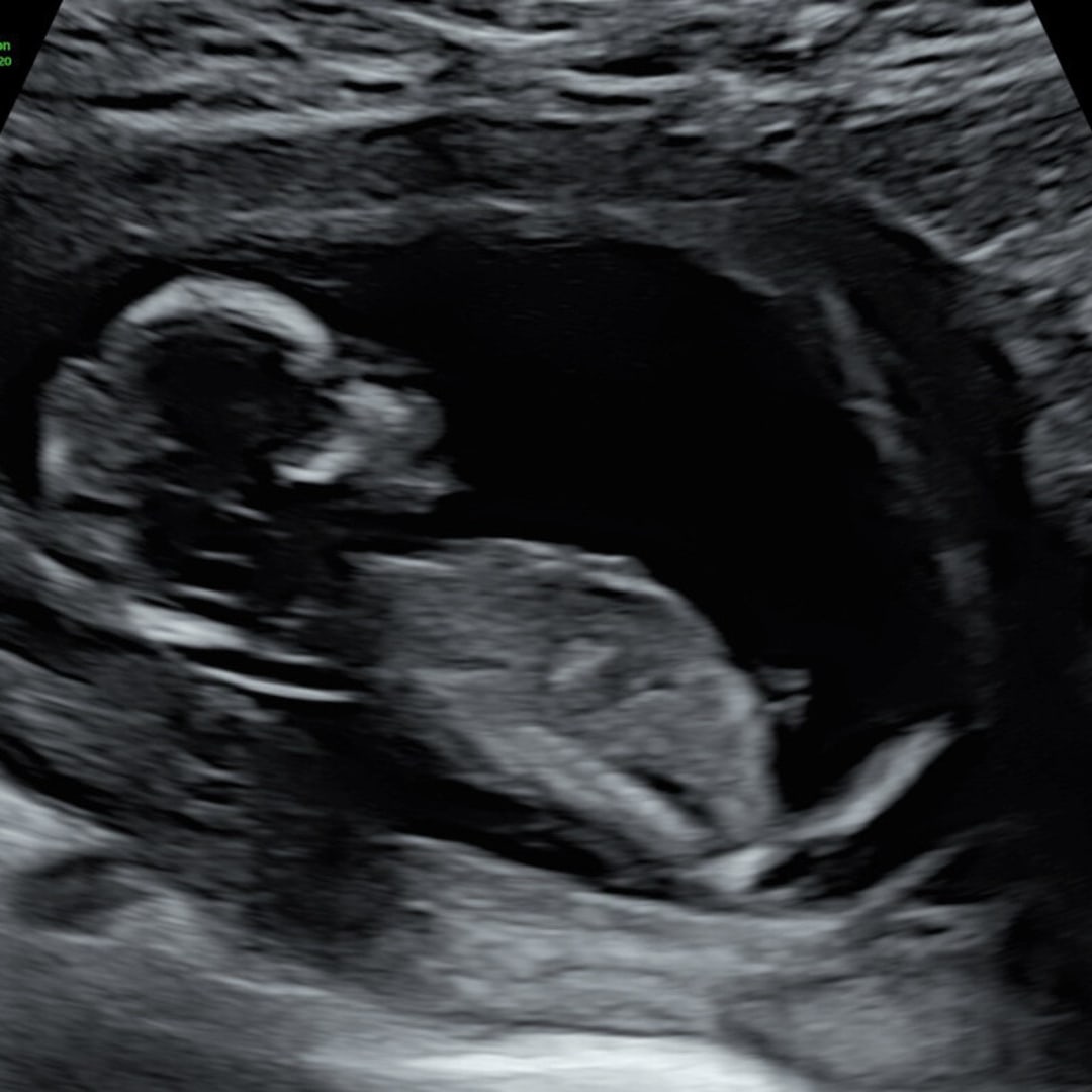 Photo shared by Elise for their Babylist baby registry.