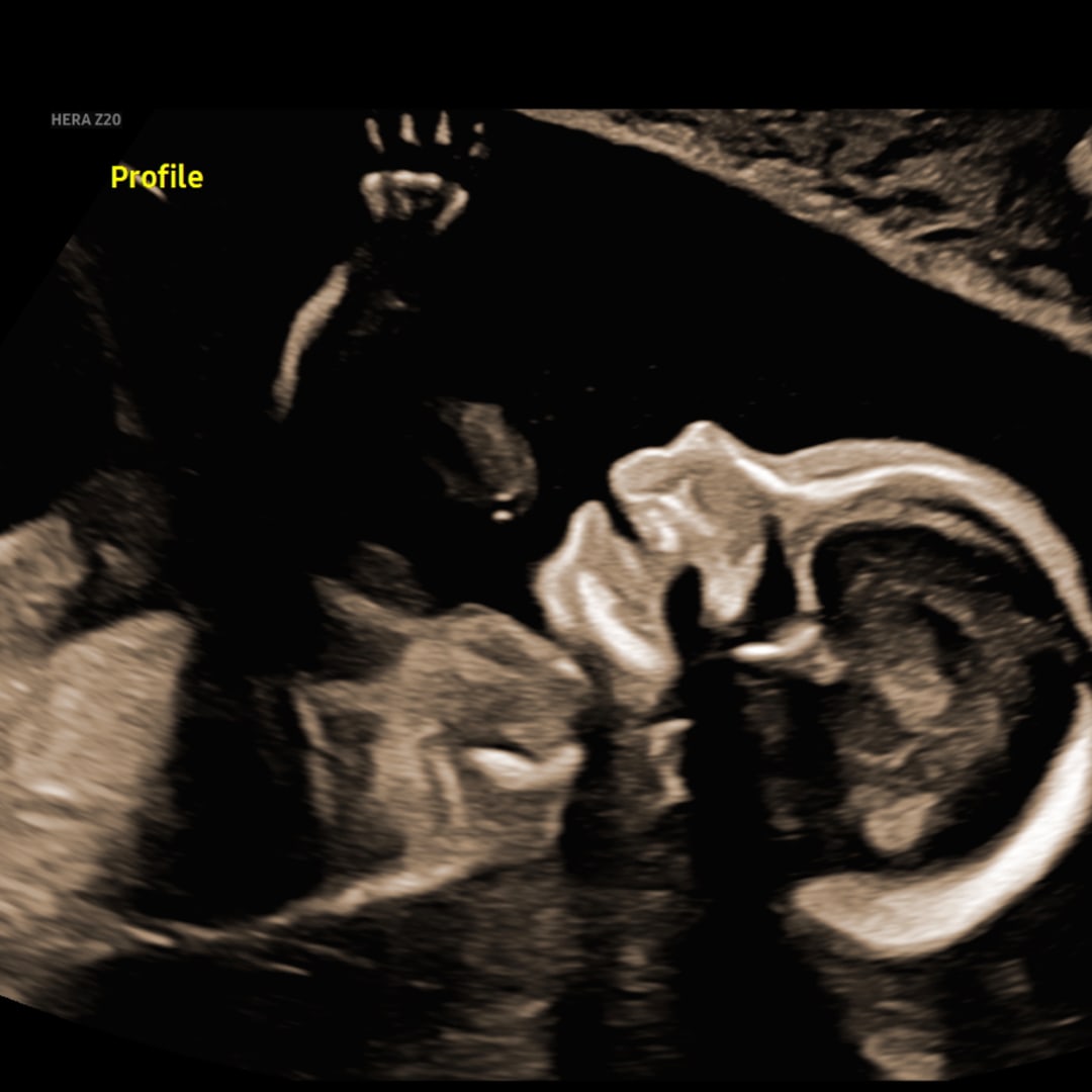 Photo shared by Brooke for their Babylist baby registry.