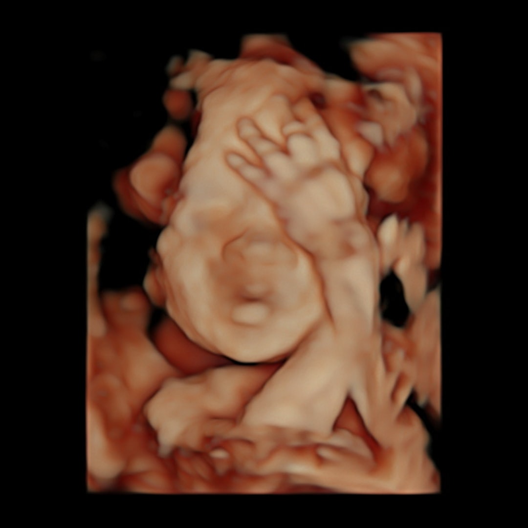 Photo shared by Brilee for their Babylist baby registry.