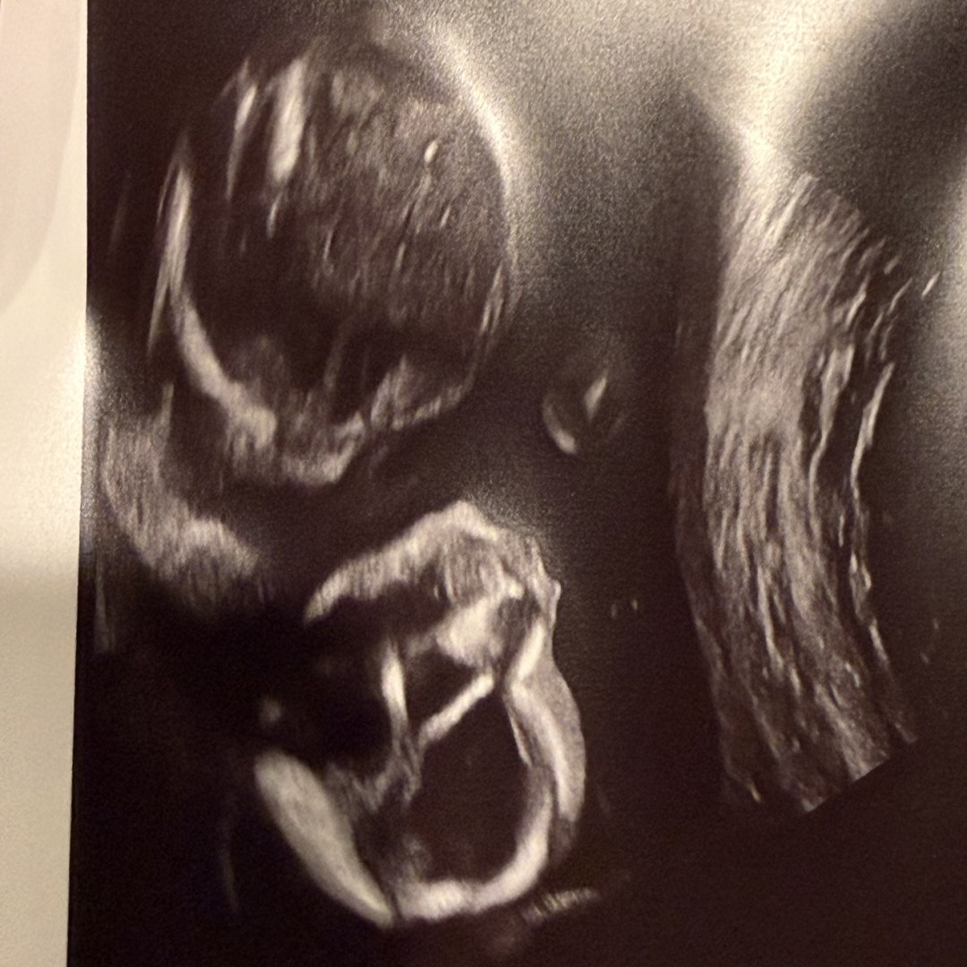 Photo shared by Breyauna for their Babylist baby registry.