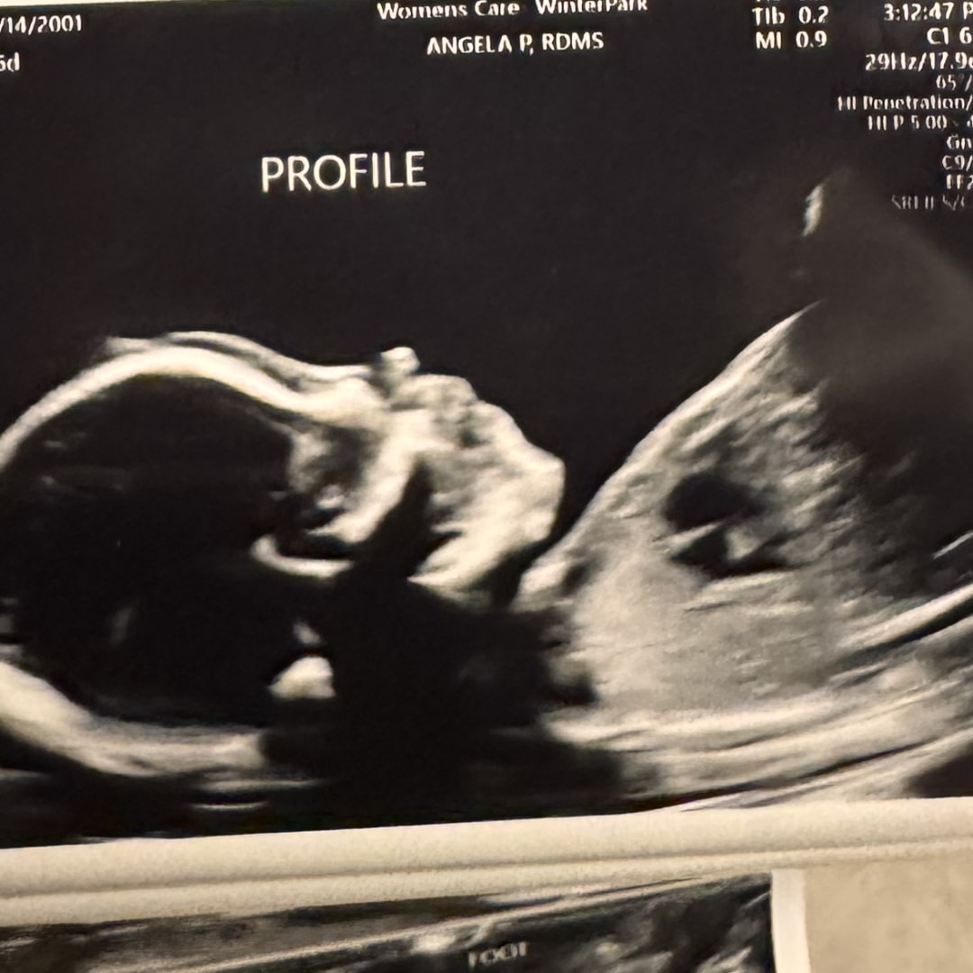 Photo shared by Perla for their Babylist baby registry.