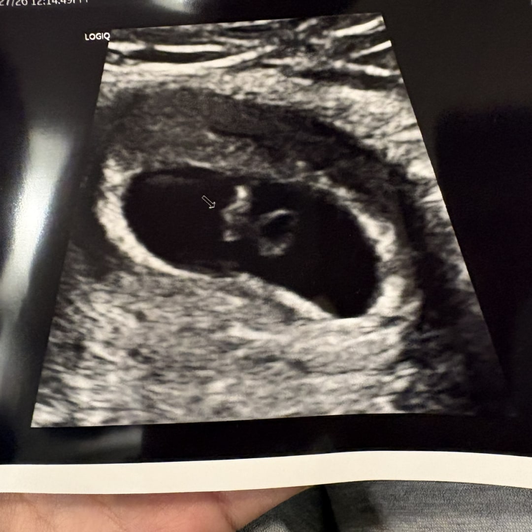 Photo shared by Ingrid for their Babylist baby registry.