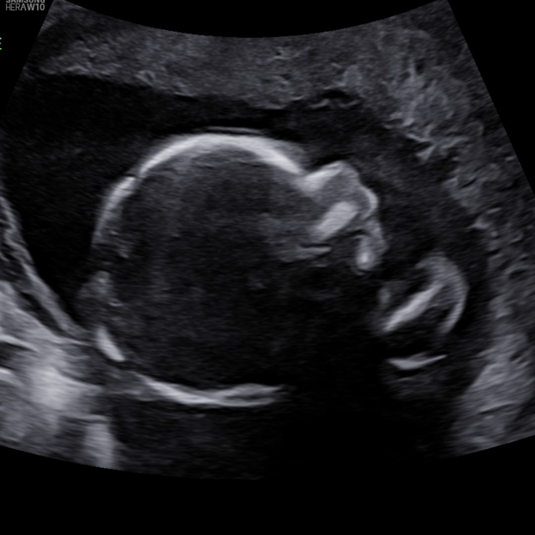 Photo shared by Erin for their Babylist baby registry.