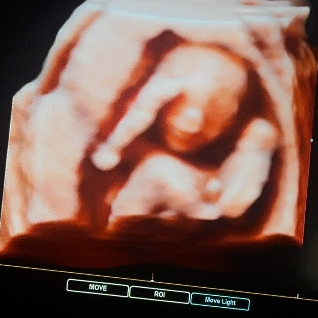 Photo shared by Alexa for their Babylist baby registry.