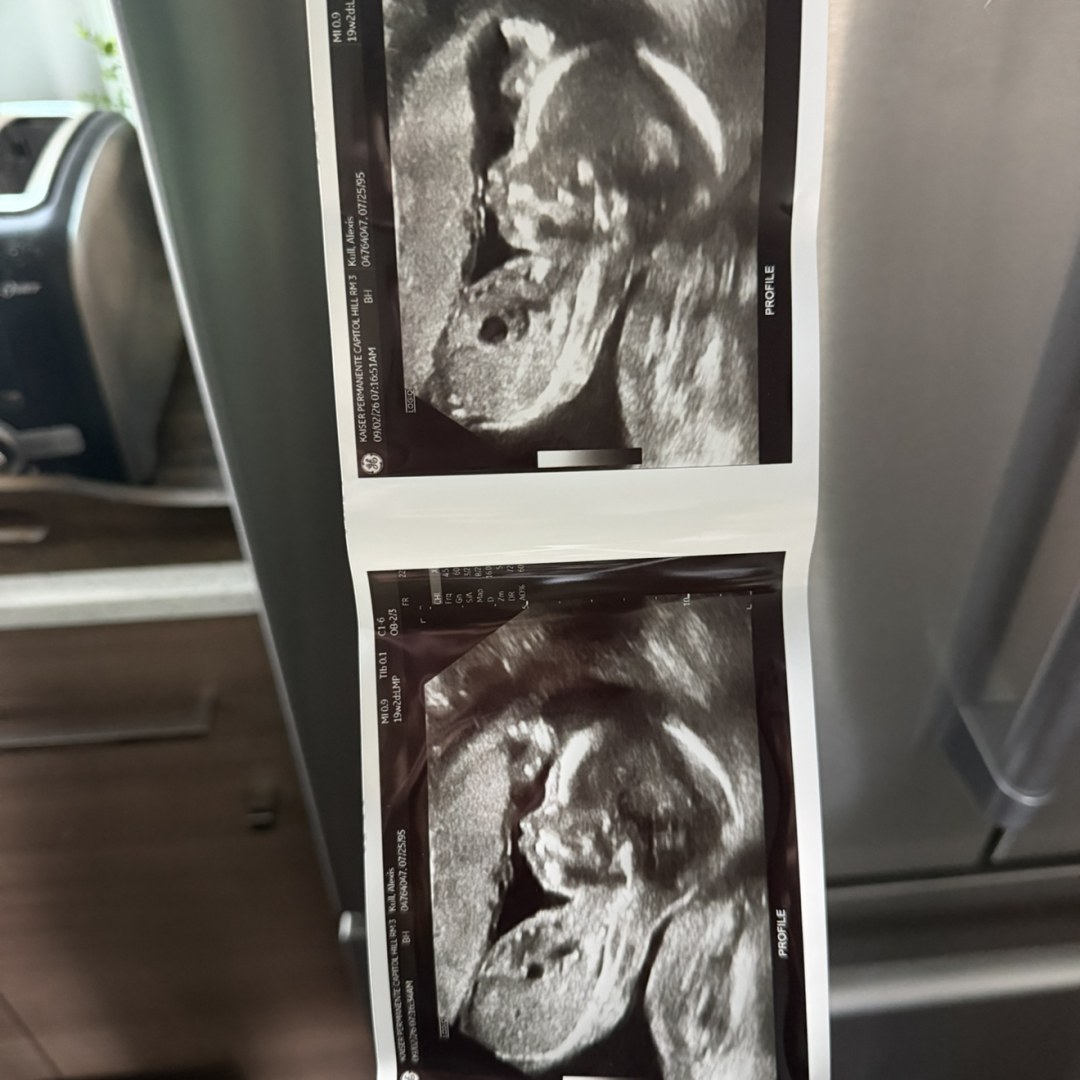 Photo shared by Alexis for their Babylist baby registry.