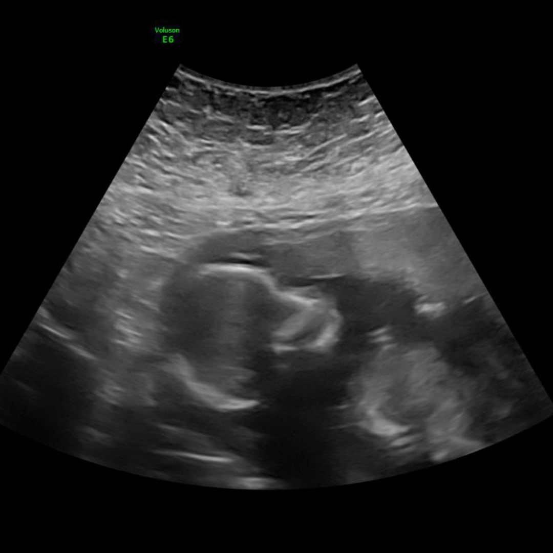 Photo shared by Reyna for their Babylist baby registry.