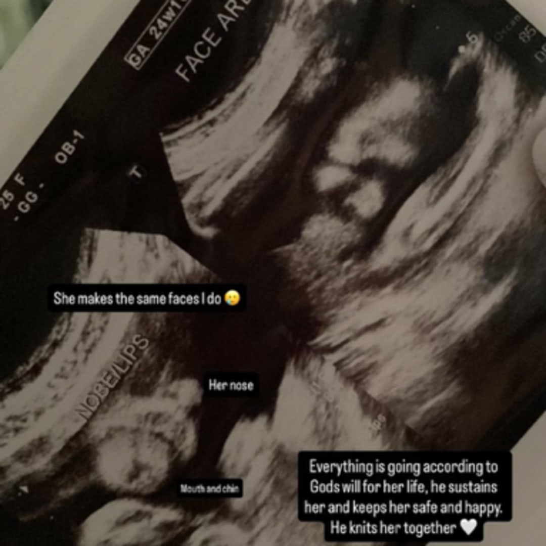 Photo shared by Amber for their Babylist baby registry.