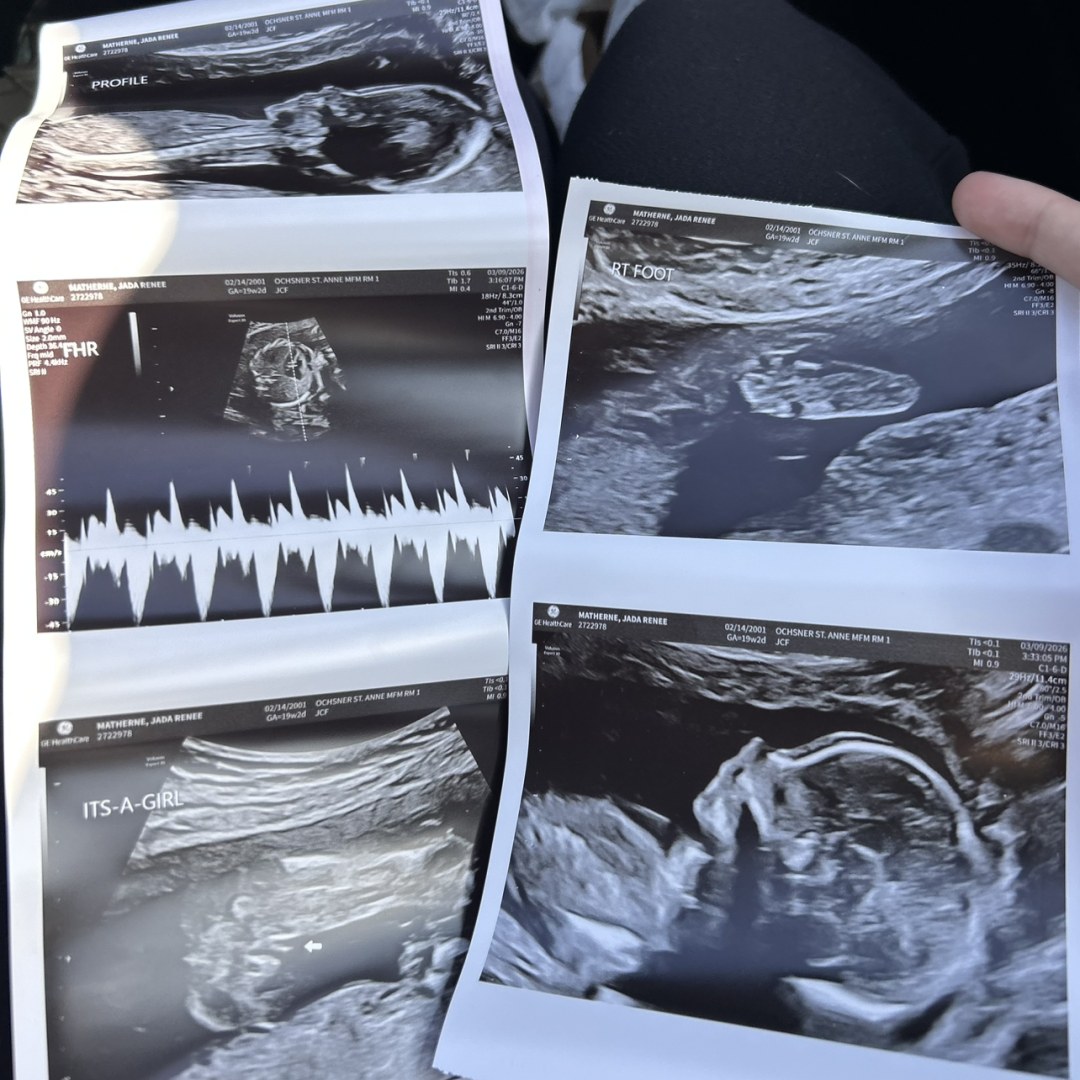 Photo shared by Jada for their Babylist baby registry.