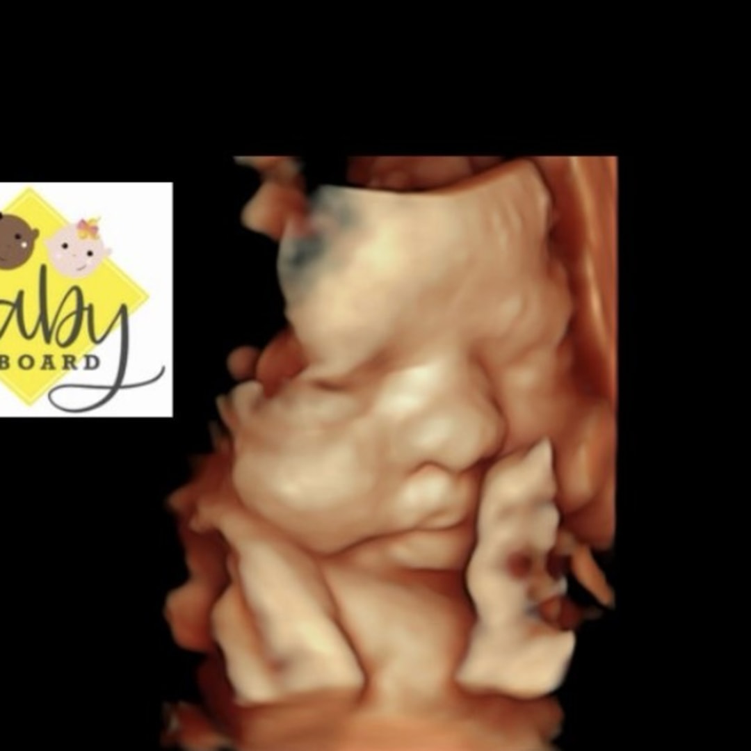 Photo shared by Leah for their Babylist baby registry.