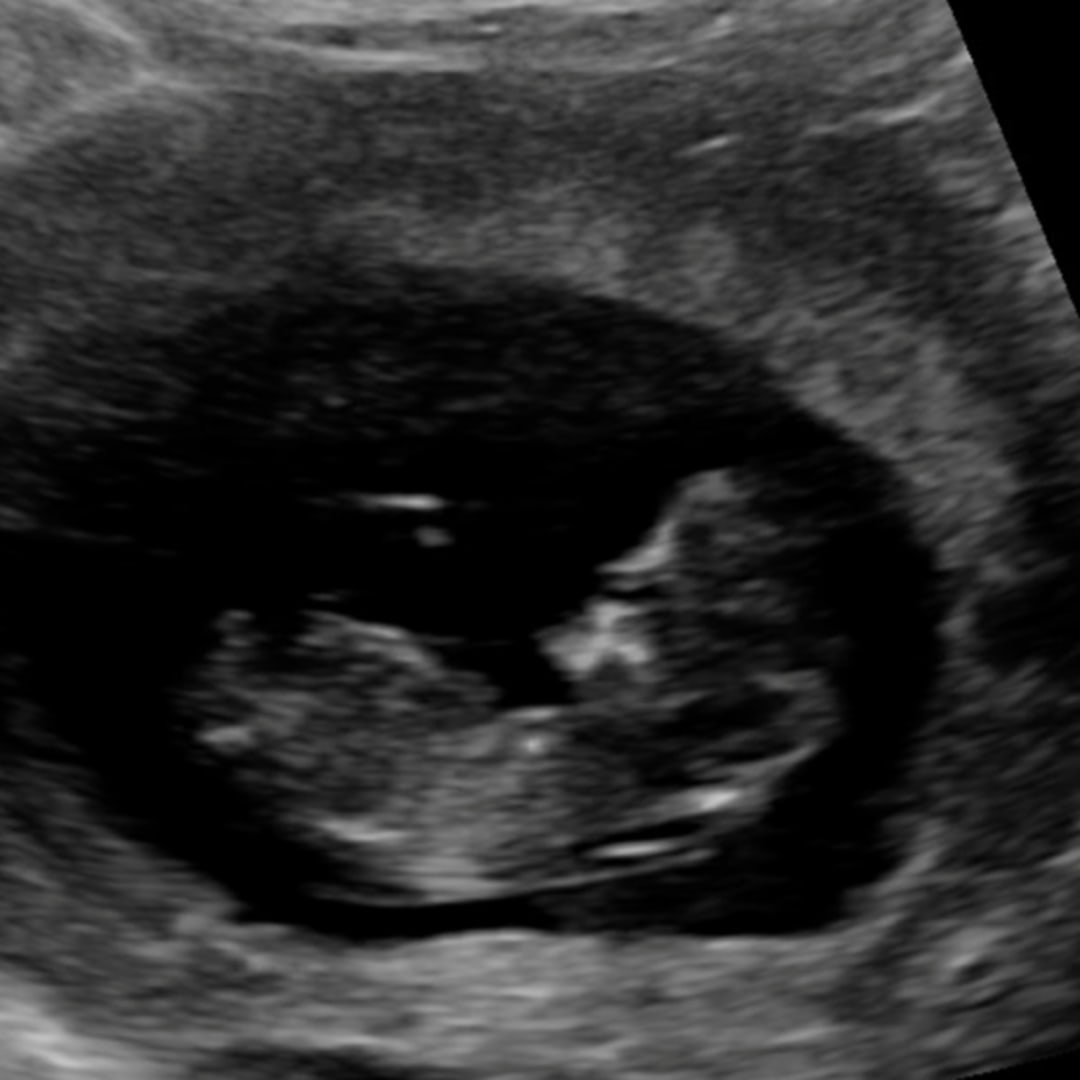 Photo shared by Shelby for their Babylist baby registry.