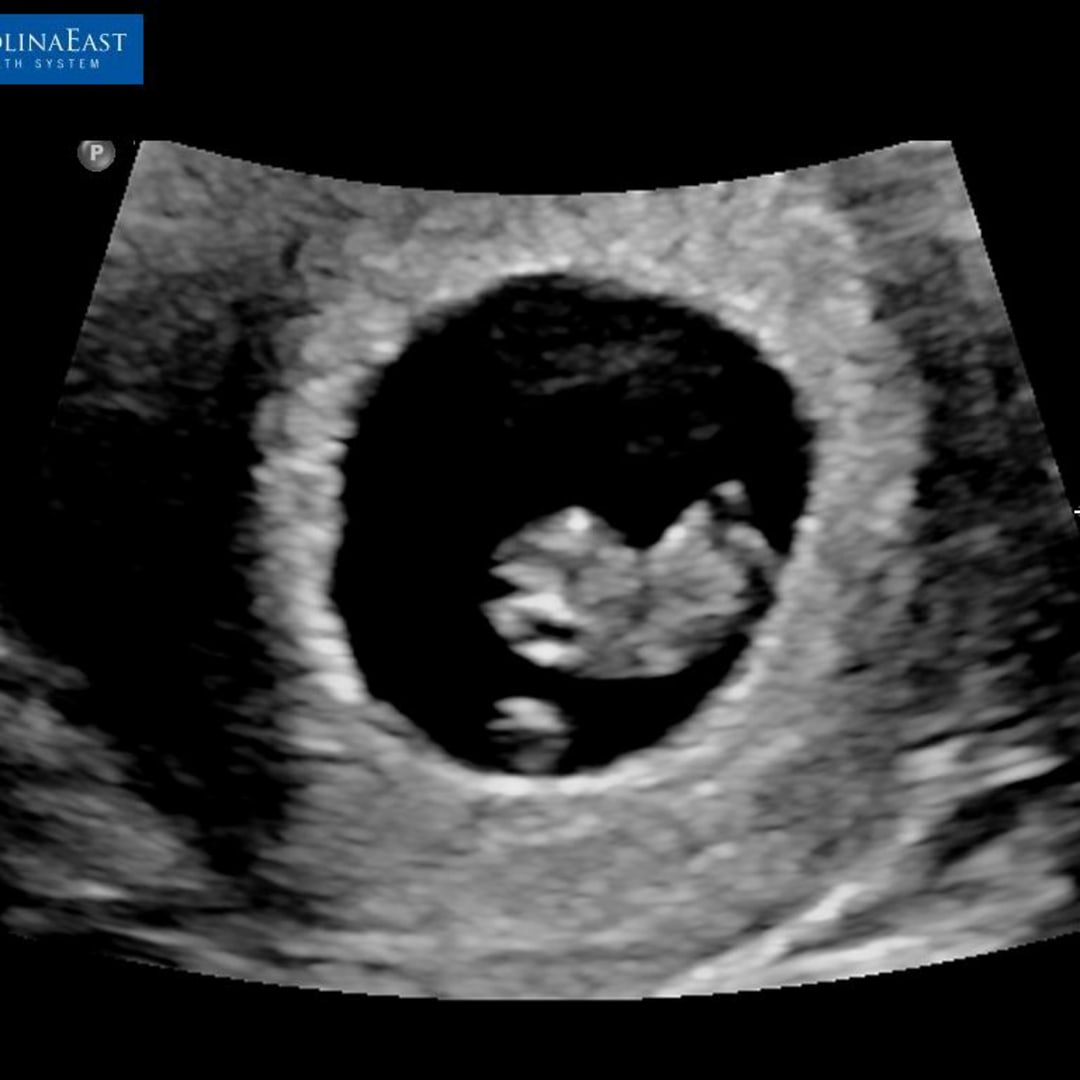 Photo shared by Kinder for their Babylist baby registry.