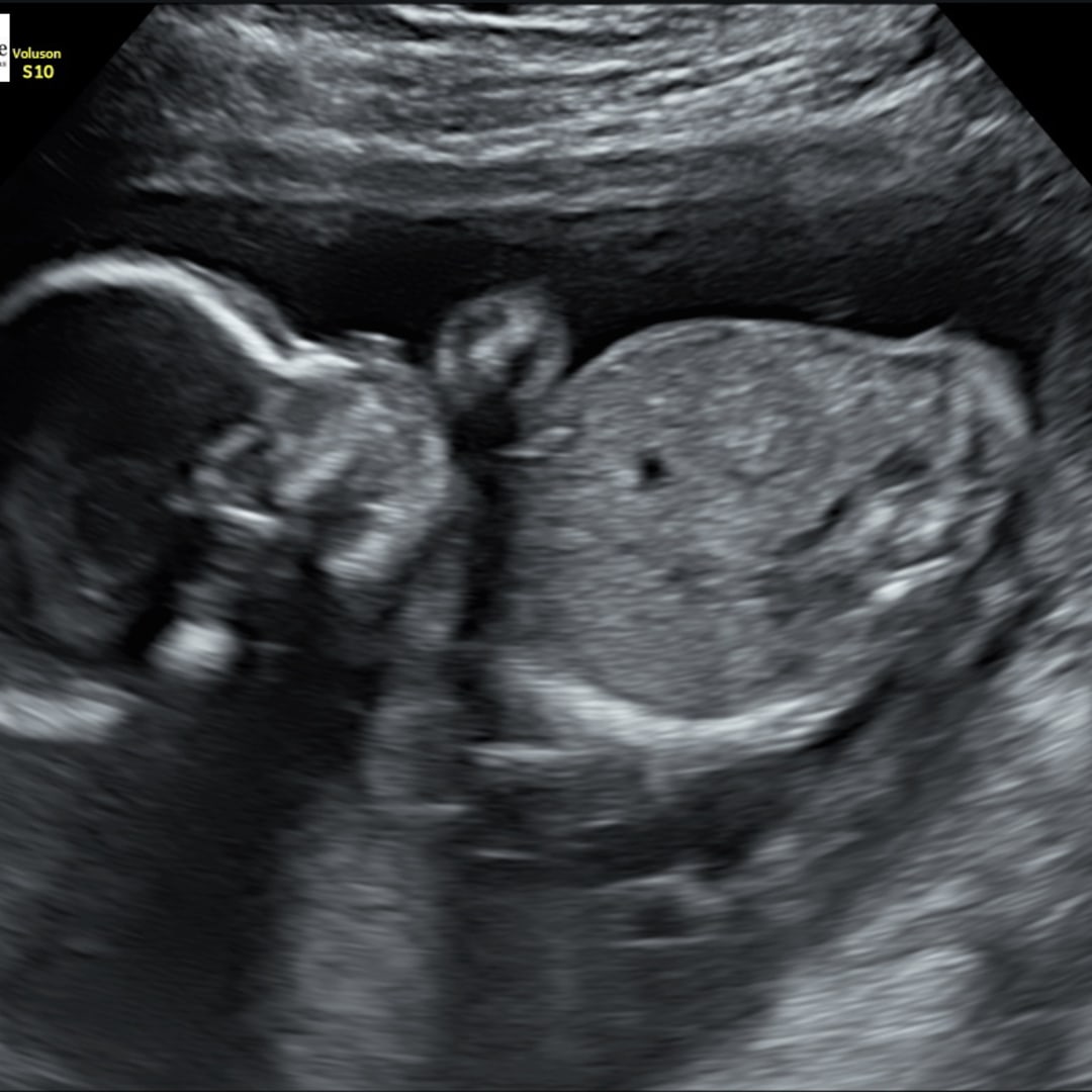 Photo shared by Belen for their Babylist baby registry.